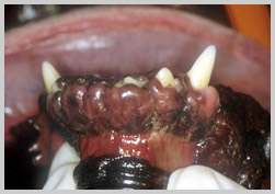 Gingival hyperplasia in incisors region